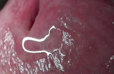 Crocodile Mouth Releases Fluid