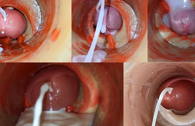 Insemination - Internal Camera Captures Deep Male Ejaculation