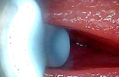 Insemination - Internal Camera Captures Deep Male Ejaculation