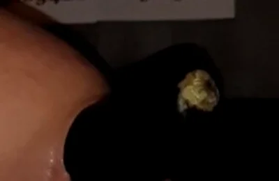 2 Huge Anal Eggplants Insertion ..big Anal Stretching!!