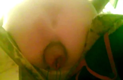 A Young Guy Is Sitting on a Chair with Anal Prolapse