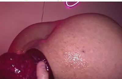 Promo Arty Boer And Trophy Muscle Extreme Prolapse Fisting