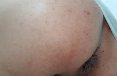 My Butt Is Dripping