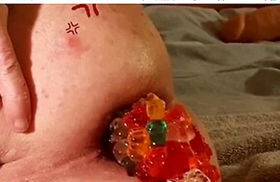 Big Load Of Gummy Bears Anal Stuffing And Expulsion Whit Prolapse