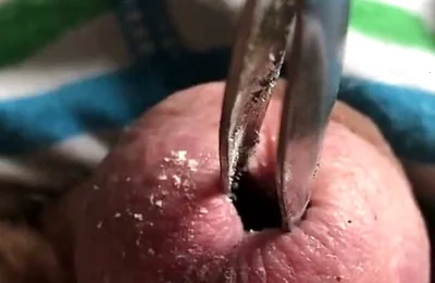 Put that match out