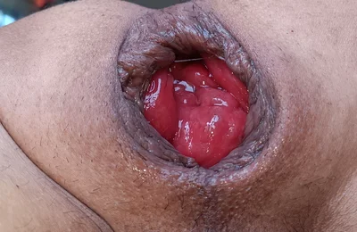 A Good Binge of Vegetables and Vegetables From the Glutton