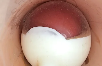 I Couldn’t Believe What Happens Inside the Penis as Sperm Passes Through (endoscopic Footage)