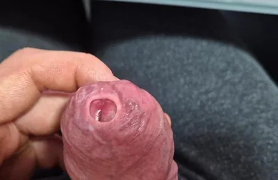 Phimosis Cock Edging with Tight Foreskin