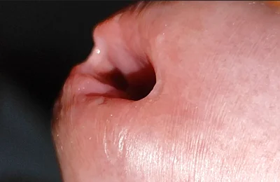 Close-up of Glans Ejaculating Intensely Before Cumming.