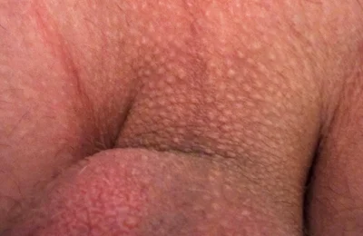 Twinks Ass Is so Nice and Wet After Cum Inside